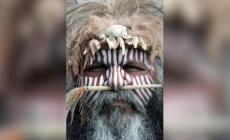 الحمار الوحشي يلهم العلماء كيفية الوقاية من لدغ الحشرات