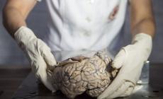 لأول مرة.. علماء يستيطعون زراعة دماغ بشري مخبريا