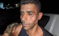 نقل الأسير زكريا الزبيدي لمستشفى "رمبام" للعلاج