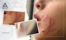 الطفل محمد سلامة