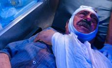 صورة لمواطن نقل بالاسعاف بعد الاعتداء عليه