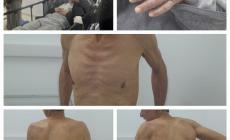 نادي الأسير الفلسطيني: الأسرى المحررون يعانون من مشاكل صحية خطيرة