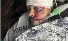 الشاب مؤمن أبو عمشة من غرفة العناية المركزة في مستشفى المعمداني