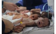 مدير مجمع الشفاء الطبي: أطفال غزة يواجهون كارثة صحية بسبب سوء التغذية