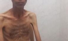 عالق بين الألم والجوع… فيصل أبو ضاهر يبحث عن منقذ لحياته 