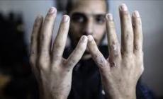 الزغاري: سجون الاحتلال (الإسرائيلي) تحوّلت إلى ساحات قتل بطيء وتعذيب ممنهج