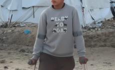 قبرٌ لقدمٍ مبتورة… طفولة عمر حلاوة التي دُفنت قرب الخيمة