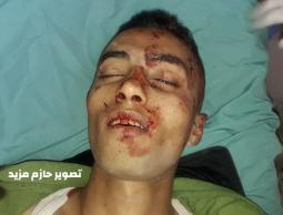 الشهيد لم تعرف هويته بعد