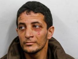 تظهر عليه آثار التعذيب