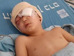 استئصال عين طفل أصيب برصاص الاحتلال في العيسوية