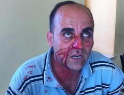 الأورومتوسطي يطالب بتحقيق عاجل في قتل الناشط نزار بنات