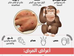 حقائق حول جدري القردة.jpg