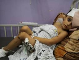 مستشفى العيون في غزة على حافة الانهيار بسبب نقص حاد في المواد الطبية