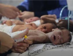 مدير مجمع الشفاء الطبي: أطفال غزة يواجهون كارثة صحية بسبب سوء التغذية