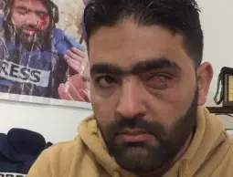 مركز حماية الصحفيين يدين تجديد الاعتقال الإداري للصحفي الجريح معاذ عمارنة