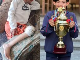 من ملاعب الحلم إلى سرير المعاناة.. مهند التلمس يواجه شللًا يهدد مستقبله