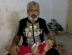 عائلة مراد.. مشربهم دواء وطعامهم خبز مبلل !