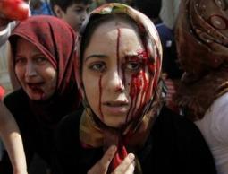 مصابات في قصف للنظام السوري (الأرشيف)