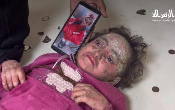 الطفلة مريم تعاني من مرض جلدي غامض، بينما يهدد الاحتلال حياتها بمنعها من السفر للعلاج.