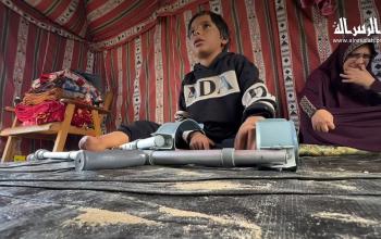 إسلام الفيراني.. جرح في الجسد وقوة في الروح بعد فقدان قدمه جراء قصف الاحتلال