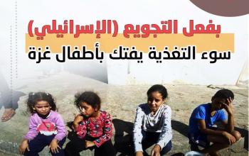 بفعل التجويع (الإسرائيلي).. سوء التغذية يفتك بأطفال غزة