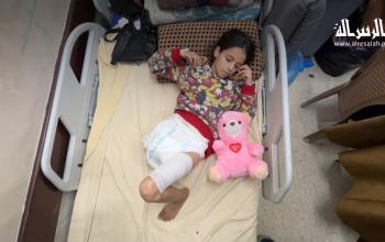 الطفلة هبة مهنا 9 أعوام.. تواجه ألم التهجير وبتر الساق