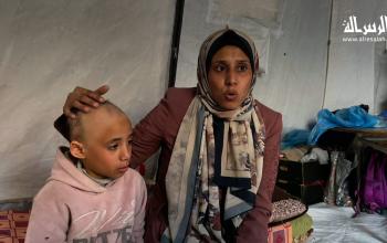 الطفلة سما طبيل، فقدت شعرها بسبب الصدمة والخوف الناتجين عن غارات الاحتلال