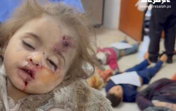 قتلوا البراءة، ودمروا الطفولة في أبشع صور الإبادة الجماعية أطفال غزة