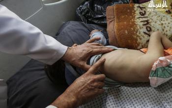 أطفال يتلقون الرعاية الصحية في مستشفى الرنتيسي بمدينة غزة بسبب سوء التغذية