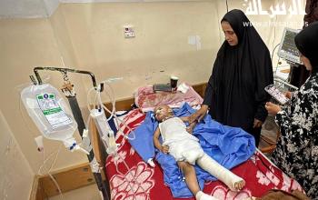 الطفل عمرو الهمص(٣ أعوام) يتلقى الرعاية الطبية في مستشفى ناصر الطبي بعد أن فقد كل أسرته بالقصف الإسرائيلي شمال قطاع غزة وتعرض لإصابات تهدّد حياته