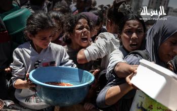 غزة تموت جوعًا.. والعالم يكتفي بالمشاهدة