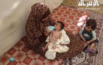 الرضيع سالم عوض حياته مهددة بسبب سوء التغذية الحاد والتجويع الذي يعاني منه قطاع غزة
