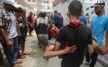 مواطنون ينقلون عددا من الشهداء والجرحى جراء قصف الاحتلال تجمعا للمواطنين في مدينة غزة