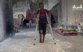 بُترت ساقه وفقد أمه.. الطفل راتب يواصل العلاج وحيدًا في دير البلح