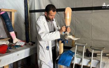 مركز تأهيل داخل خيمة في مواصي خانيونس يخدم المصابين ومبتوري الأطراف