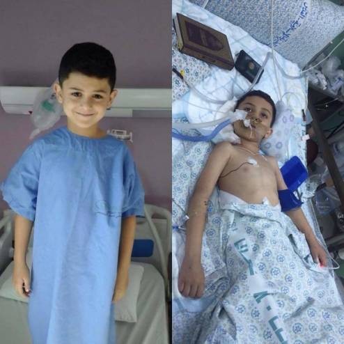 وفاة الطفل أمير زيدان بعد 3 سنوات من المعاناة