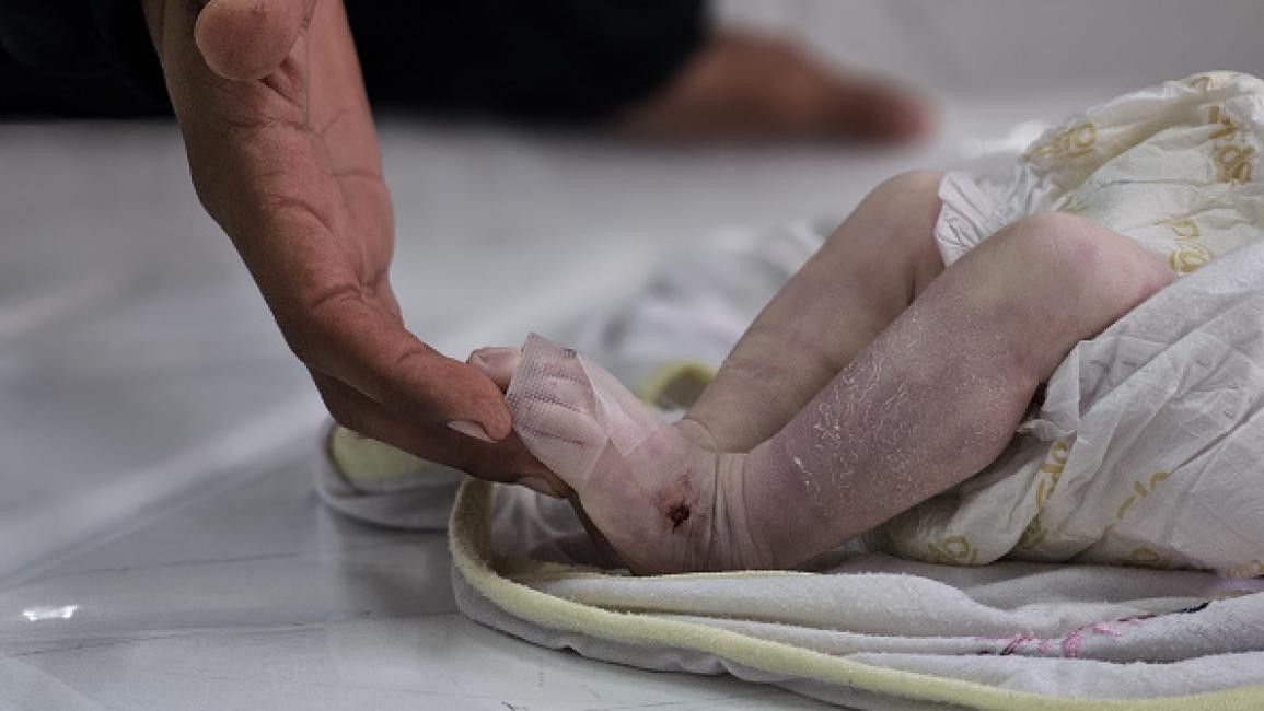 سيلا... الجسد الصغير الذي رحل تجمدا في خيام النزوح