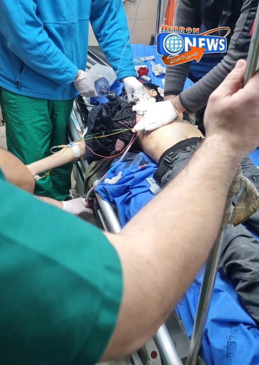 استشهاد الطفل أيمن نصار الهيموني متأثرًا بإصابته في الخليل