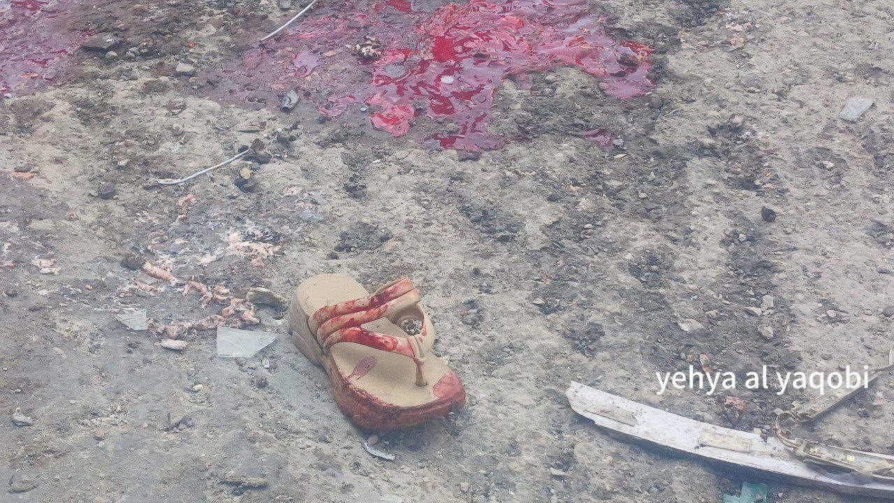 المرصد الأورومتوسطي: 94% من ضحايا العدوان على غزة مدنيون