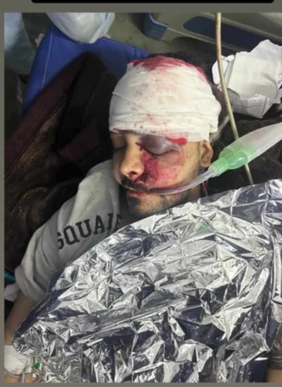 الشاب مؤمن أبو عمشة من غرفة العناية المركزة في مستشفى المعمداني