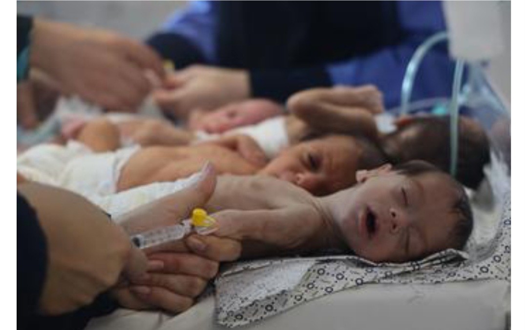 مدير مجمع الشفاء الطبي: أطفال غزة يواجهون كارثة صحية بسبب سوء التغذية