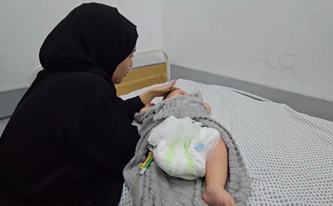 هاني… رضيع خرج من حضن أمه مبتور القدم