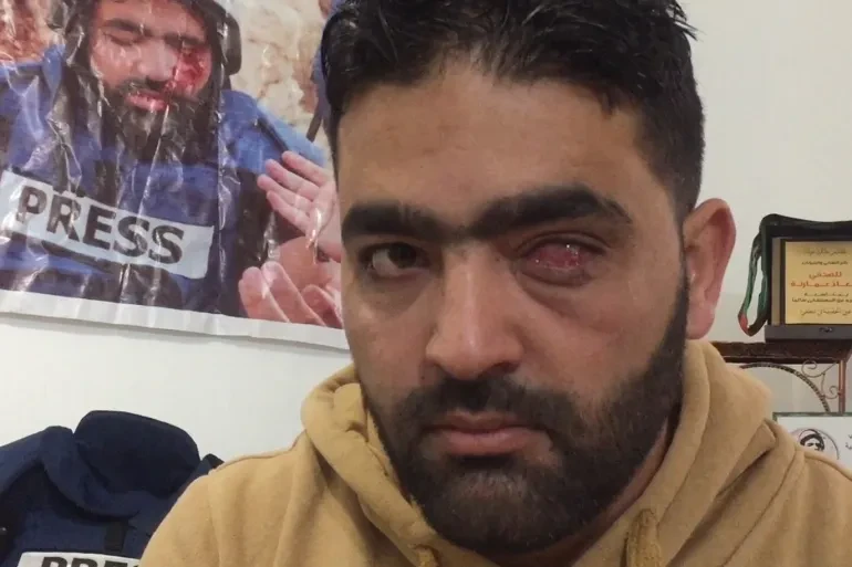 مركز حماية الصحفيين يدين تجديد الاعتقال الإداري للصحفي الجريح معاذ عمارنة
