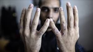 الزغاري: سجون الاحتلال (الإسرائيلي) تحوّلت إلى ساحات قتل بطيء وتعذيب ممنهج