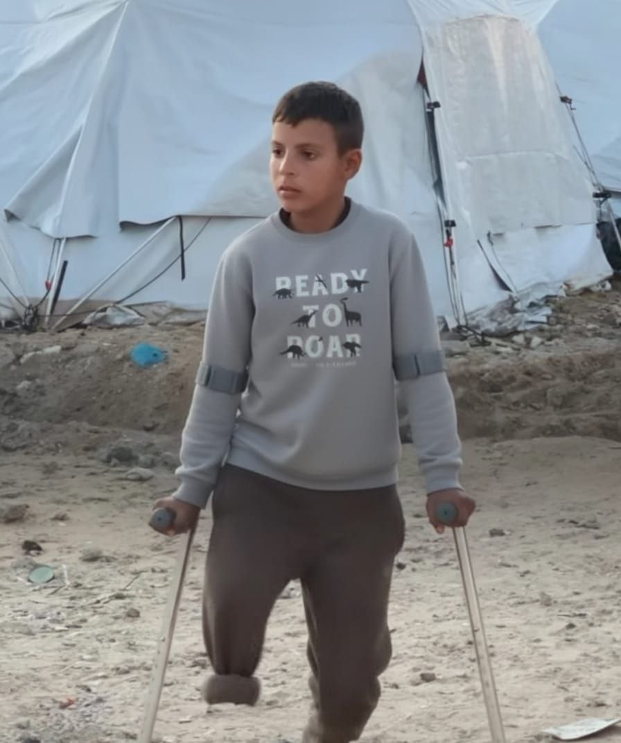 قبرٌ لقدمٍ مبتورة… طفولة عمر حلاوة التي دُفنت قرب الخيمة