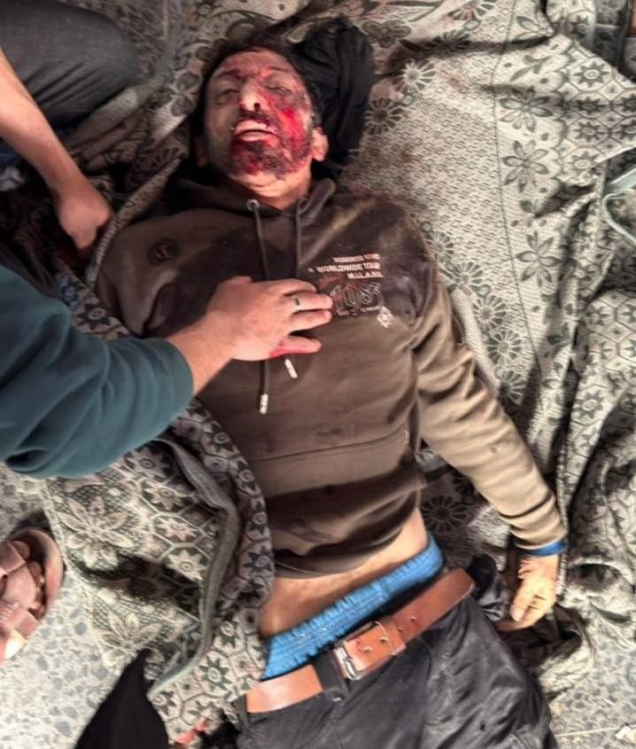 ارتقاء المواطن فهمي قدوم برصاص الاحتلال شمال قطاع غزة.