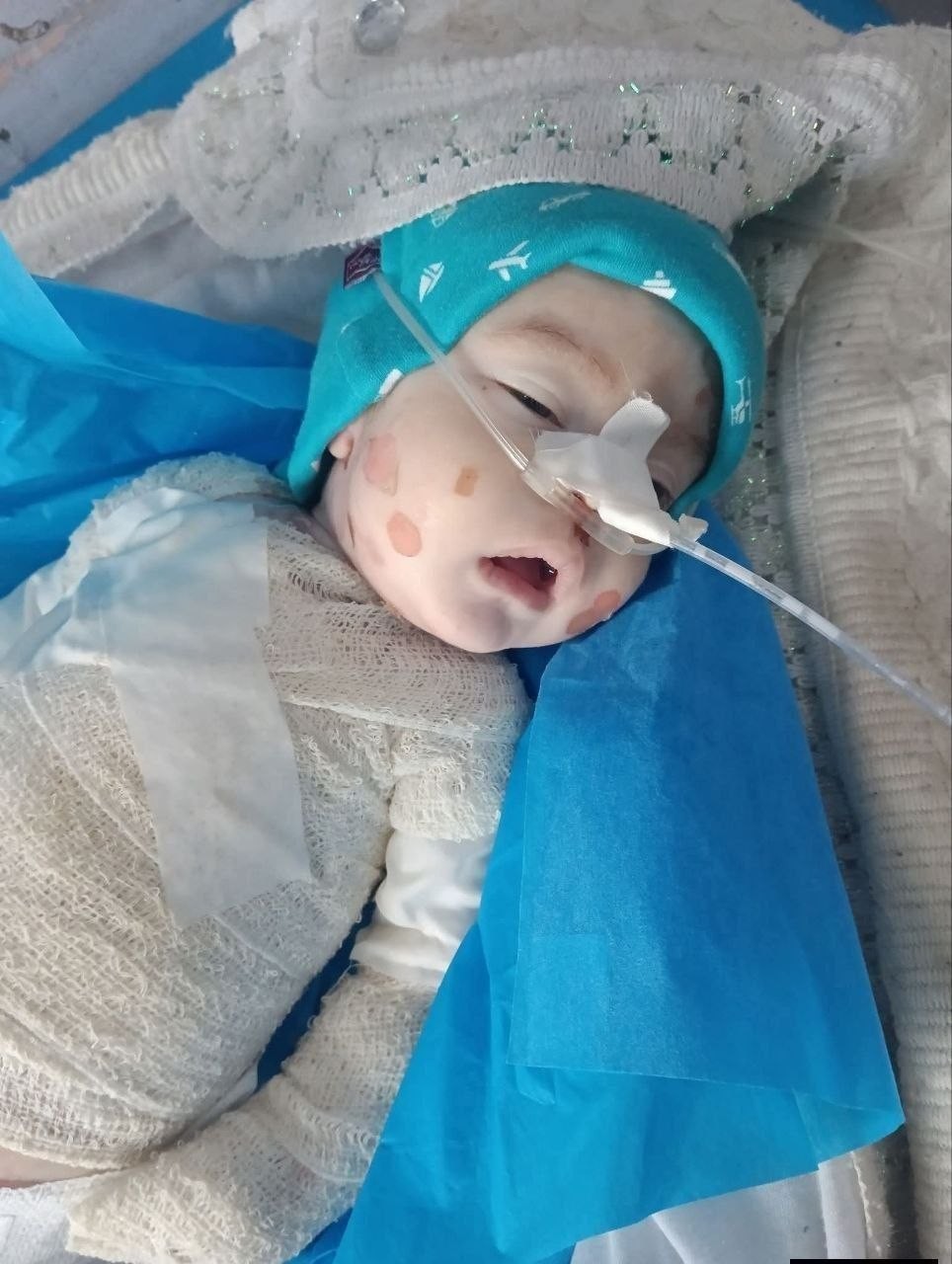 الطفل جلال القطش