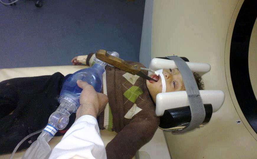 الطفل المصاب رواد أبو عليان