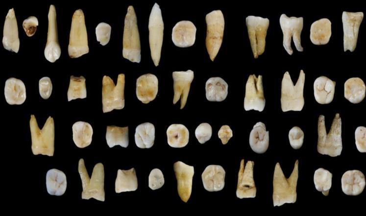 اكتشاف أسنان تعيد كتابة تاريخ الإنسان الأول