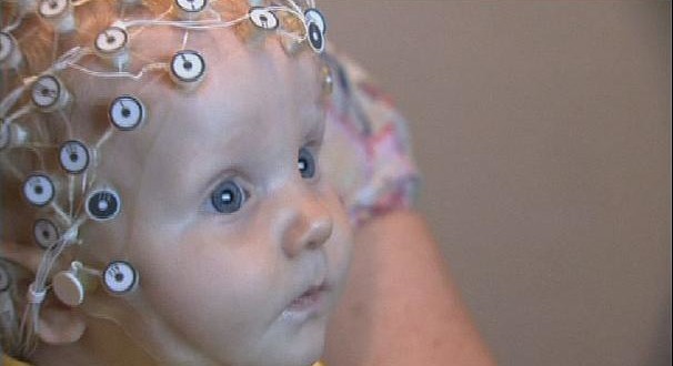 التصوير ثلاثي الأبعاد للوجه يكشف التوحد